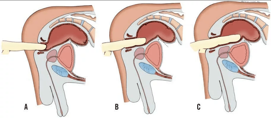 Rectum